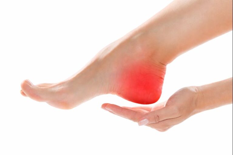 Close-up of heel pain while walking, showing inflamed heel area supported by hand